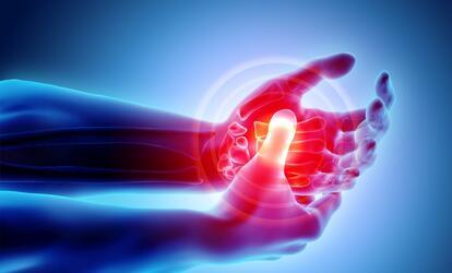 Mi az a rheumatoid arthritis? Mi az a rheumatoid arthritis?