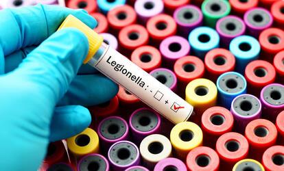 Legionella baktérium előfordulása Legionella baktérium tudnivalók