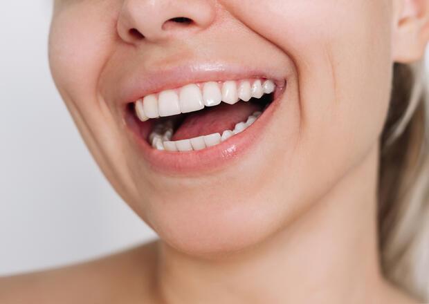 Kozmetikai fogászat 