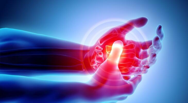Mi az a rheumatoid arthritis? Mi az a rheumatoid arthritis?