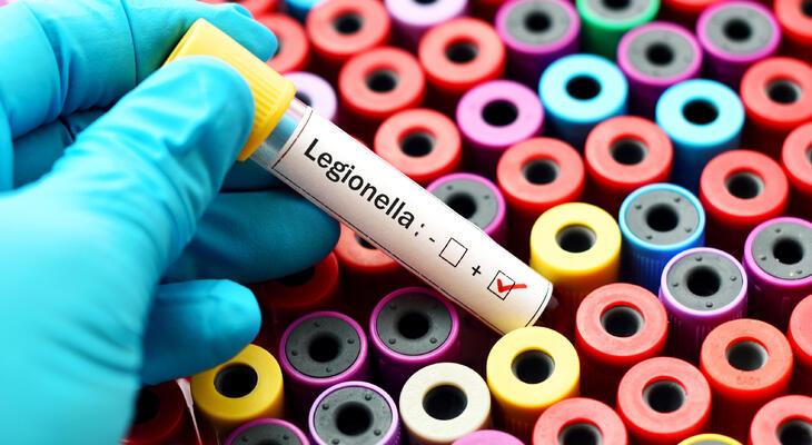 Legionella baktérium tudnivalók