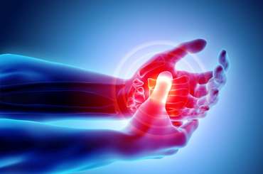 Mi az a rheumatoid arthritis?