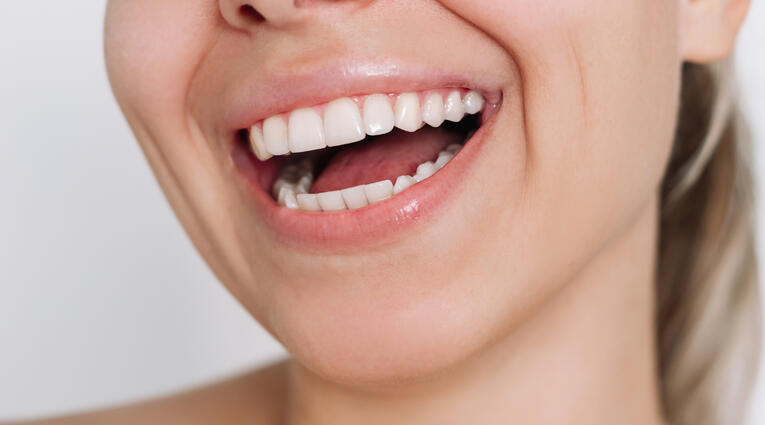 Kozmetikai fogászat 